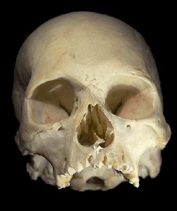 human skull pictures