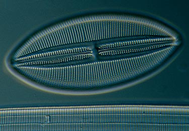diatom cell