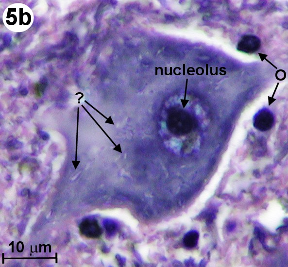 nerve cell microscope labeled