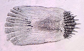 Cycloid Fish Scale  Nikon's MicroscopyU