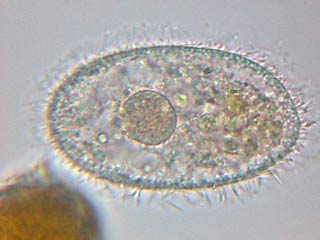 Mixed Protozoa Slide