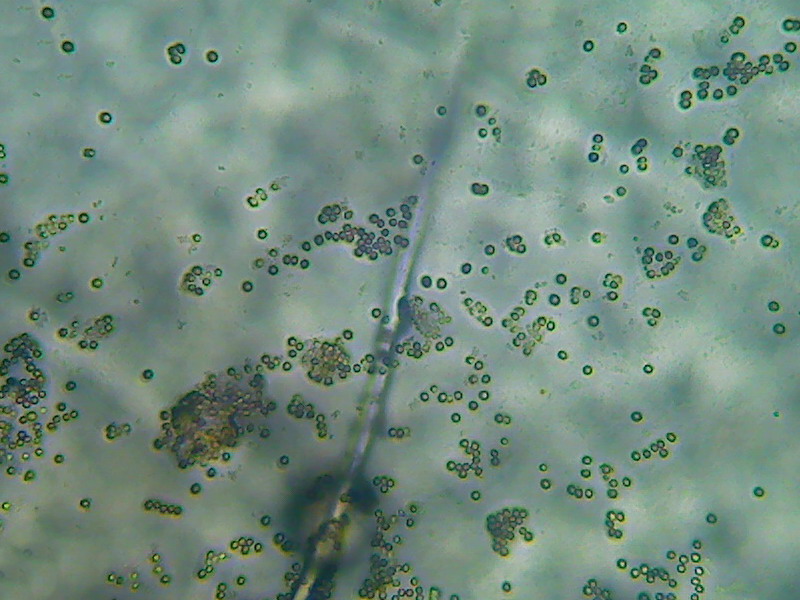 aspergillus conidiospores