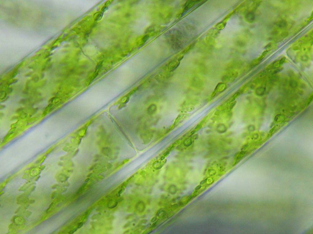 spirogyra 400x