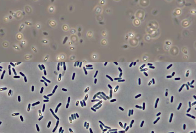 bacilus subtilis